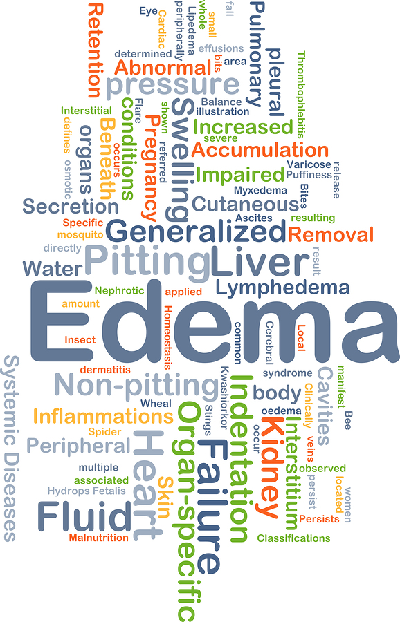 what-can-cause-edema-in-the-elderly-home-care-in-houston-and-katy-tx